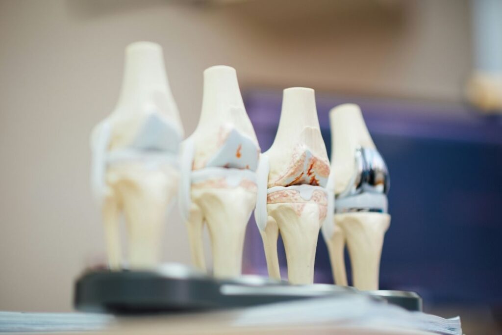 Age-related changes in muscle mass, joints, and bone density